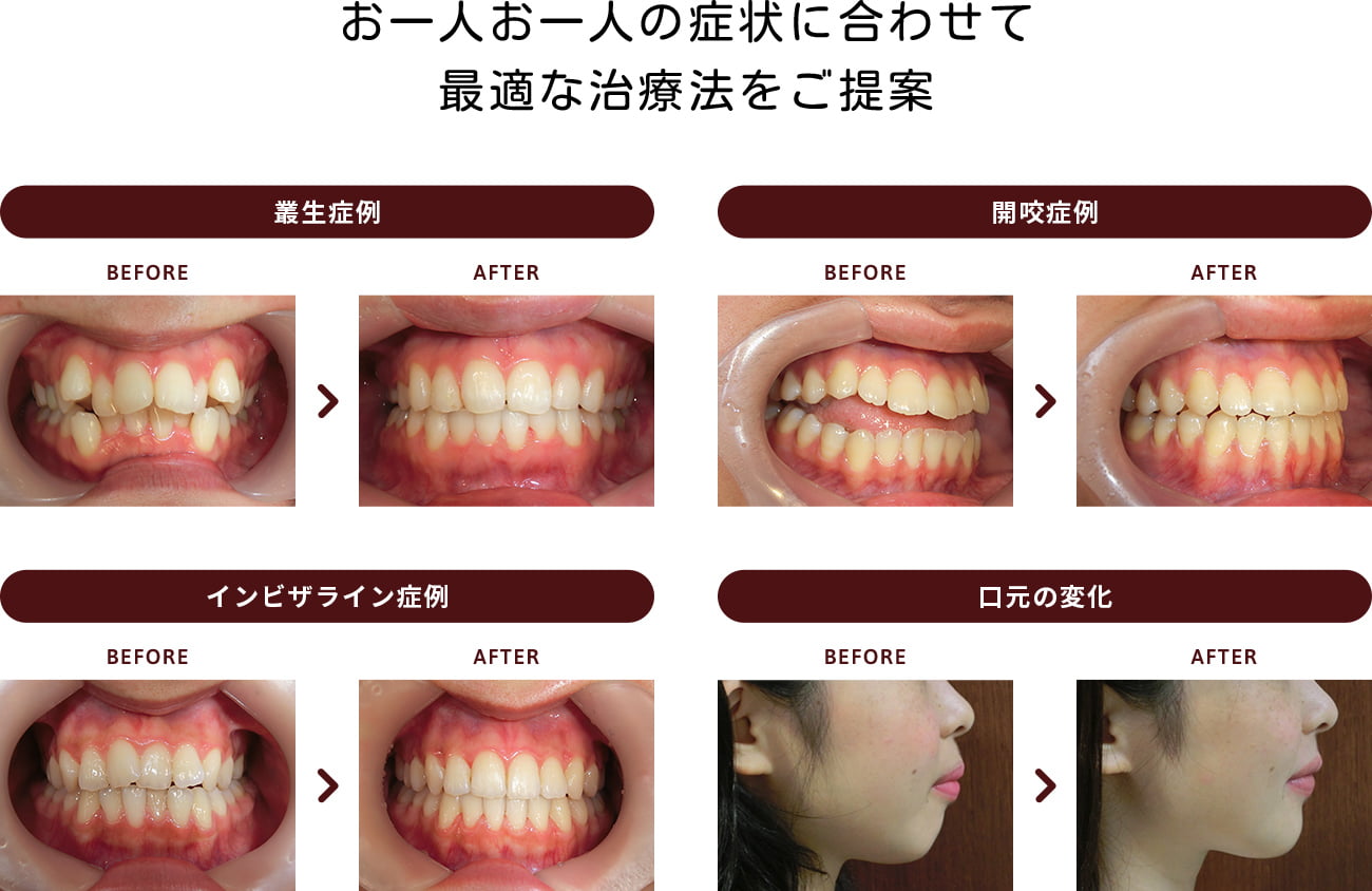 お一人お一人の症状に合わせて最適な治療法をご提案